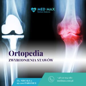 Zwyrodnienie stawów – jak ortopedia może przywrócić sprawność?